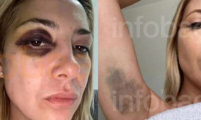 Fotos ex-primeira-dama da Argentina Fabiola Yañez é divulgada após agressão