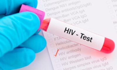 Alerta no Rio: 6 pacientes testam positivo para HIV após transplantes de órgãos